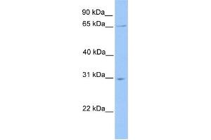WB Suggested Anti-NR1D2 Antibody Titration:  0. (NR1D2 anticorps  (N-Term))