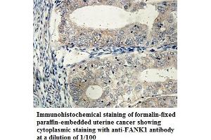 Image no. 1 for anti-Fibronectin Type III and Ankyrin Repeat Domains 1 (FANK1) antibody (ABIN1576454) (FANK1 anticorps)