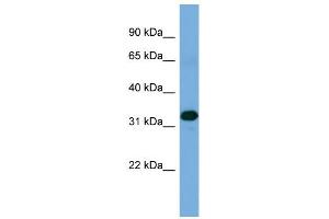 WB Suggested Anti-ZNF511 Antibody Titration: 0. (ZNF511 anticorps  (Middle Region))