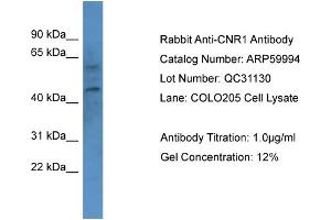 Western Blotting (WB) image for anti-Cannabinoid Receptor 1 (CNR1) (N-Term) antibody (ABIN786077) (CNR1 anticorps  (N-Term))