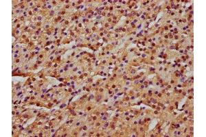 IHC image of ABIN7151301 diluted at 1:600 and staining in paraffin-embedded human adrenal gland tissue performed on a Leica BondTM system.