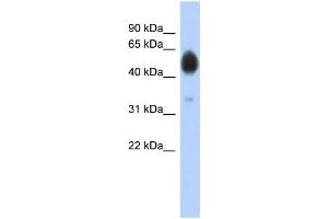 WB Suggested Anti-ARSA Antibody Titration: 0. (Arylsulfatase A anticorps  (N-Term))