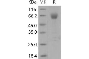 Western Blotting (WB) image for Intercellular Adhesion Molecule 2 (ICAM2) (Active) protein (Fc Tag) (ABIN7196242)