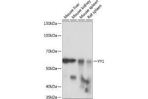 Western blot analysis of extracts of various cell lines, using YY1 antibody (ABIN7271428) at 1:1000 dilution. (YY1 anticorps)