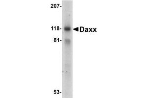 Western blot analysis of Daxx in 293 total cell lysate with AP30275PU-N Dax antibody at 1 mg/ml. (DAXX anticorps  (C-Term))