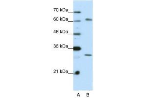 AUH antibody used at 0. (AUH anticorps  (C-Term))