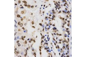 Immunohistochemistry (IHC) image for anti-Histone H3 (H3) (H3K9me3) antibody (ABIN3016030) (Histone 3 anticorps  (H3K9me3))