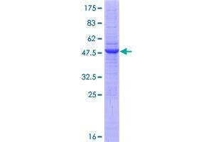 Image no. 1 for Ring Finger Protein 170 (RNF170) (AA 1-200) protein (GST tag) (ABIN1318299)