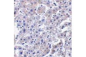 Immunohistochemistry of caspase-14 in human liver tissue with caspase-14 antibody at 2.