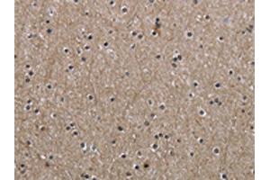 The image on the left is immunohistochemistry of paraffin-embedded Human brain tissue using ABIN7130674(PPAT Antibody) at dilution 1/50, on the right is treated with fusion protein. (PPAT anticorps)