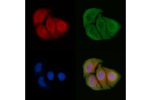 ABIN6265700 and ABIN6266665 staining Hela cells by IF/ICC. (TRADD anticorps  (N-Term))