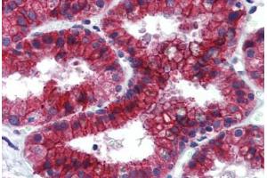 Human Prostate: Formalin-Fixed, Paraffin-Embedded (FFPE)