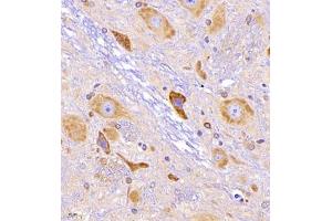 Immunohistochemistry of paraffin embedded rat epencephalon using CRMP3 (ABIN7073734) at dilution of 1:650 (400x lens) (DPYSL4 anticorps)