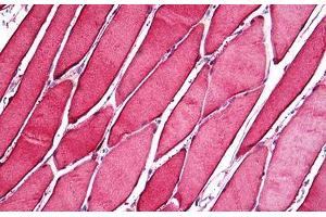 Human Skeletal Muscle: Formalin-Fixed, Paraffin-Embedded (FFPE)