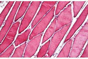 Human Skeletal Muscle: Formalin-Fixed, Paraffin-Embedded (FFPE) (CA3 anticorps  (AA 1-261))