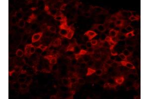 Immunofluorescence (IF) image for anti-Fatty Acid Synthase (FASN) (AA 2462-2511) antibody (ABIN7448964) (Fatty Acid Synthase anticorps  (AA 2462-2511))