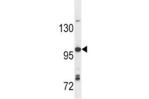 Anti-TLR7 antibody western blot analysis in Ramos lysate (TLR7 anticorps  (AA 98-128))