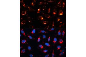 Immunofluorescence analysis of U2OS cells using Cytokeratin 18 (KRT18) antibody (ABIN7268098) at dilution of 1:100.