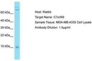 Image no. 1 for anti-Chromosome 7 Open Reading Frame 49 (C7ORF49) (AA 8-57) antibody (ABIN6750662) (C7orf49 anticorps  (AA 8-57))
