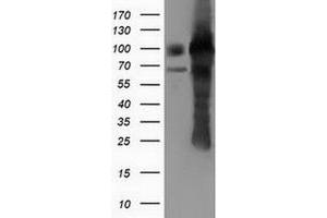 Western Blotting (WB) image for anti-Pseudouridylate Synthase 7 Homolog (PUS7) antibody (ABIN1500514) (PUS7 anticorps)