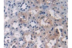 Detection of OAS1 in Rat Kidney Tissue using Polyclonal Antibody to 2',5'-Oligoadenylate Synthetase 1 (OAS1) (OAS1 anticorps  (AA 139-358))