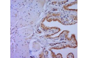 Paraformaldehyde-fixed, paraffin embedded rat bladder tissue, Antigen retrieval by boiling in sodium citrate buffer (pH6.