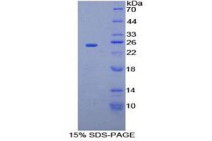 SDS-PAGE (SDS) image for Sprouty Homolog 2 (SPRY2) (AA 116-305) protein (His tag) (ABIN1878241)