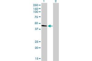 Western Blot analysis of TUBA1 expression in transfected 293T cell line by TUBA1 monoclonal antibody (M01), clone 2E11.