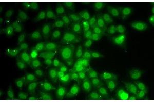 Immunofluorescence analysis of A549 cells using TRAF4 Polyclonal Antibody (TRAF4 anticorps)