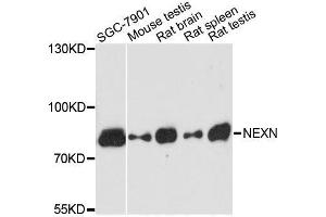 Western blot analysis of extracts of various cell lines, using NEXN antibody. (NEXN anticorps  (AA 516-675))