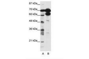 Image no. 1 for anti-Zinc Finger Protein 76 (Expressed in Testis) (ZNF76) (N-Term) antibody (ABIN202772) (ZNF76 anticorps  (N-Term))
