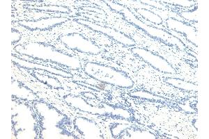 (ABIN184679) Negative Control showing staining of paraffin embedded Human Prostate, with no primary antibody. (NUMB anticorps  (C-Term))