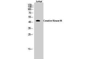 Western Blotting (WB) image for anti-Creatine Kinase, Muscle (CKM) (N-Term) antibody (ABIN3184074) (CKM anticorps  (N-Term))