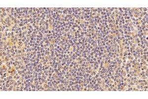 Detection of LMNB1 in Human amygdalitis Tissue using Anti-Lamin B1 (LMNB1) Monoclonal Antibody