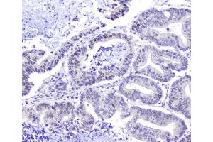 IHC analysis of Hsp105 using anti-Hsp105 antibody (ABIN5693036). (HSPH1 anticorps  (AA 653-858))