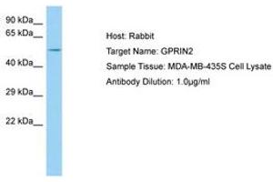 Image no. 1 for anti-G Protein Regulated Inducer of Neurite Outgrowth 2 (GPRIN2) (AA 21-70) antibody (ABIN6750104) (GPRIN2 anticorps  (AA 21-70))