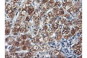 Immunohistochemical staining of paraffin-embedded Human liver tissue using anti-HARS2 mouse monoclonal antibody. (HARS2 anticorps)