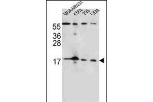 FGF22 Antibody (N-term) (ABIN656125 and ABIN2845466) western blot analysis in MDA-M,K562,293,CEM cell line lysates (35 μg/lane). (FGF22 anticorps  (N-Term))