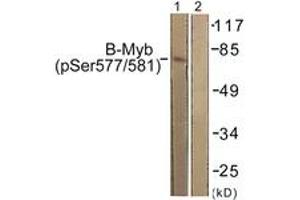 Western blot analysis of extracts from K562 cells, using B-Myb (Phospho-Ser577/581) Antibody. (MYBL2 anticorps  (pSer577))