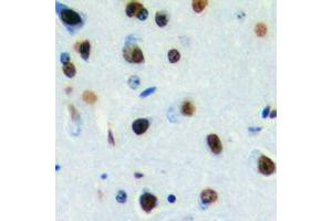 Immunohistochemical analysis of DLX3 staining in human brain formalin fixed paraffin embedded tissue section.