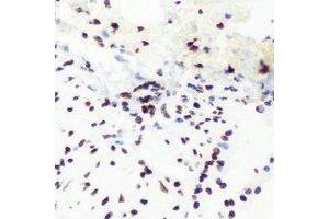 Immunohistochemical analysis of SHARP-2 staining in mouse lung formalin fixed paraffin embedded tissue section.