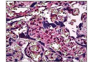 Immunohistochemistry (IHC) image for anti-SMAD, Mothers Against DPP Homolog 3 (SMAD3) antibody (ABIN781908)