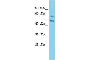 Host: Rabbit Target Name: WDR85 Sample Type: Jurkat Whole Cell lysates Antibody Dilution: 1. (Diphthamide Biosynthesis 7 (DPH7) (N-Term) anticorps)