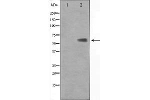 Western blot analysis on Jurkat cell lysate using KLF11 Antibody. (KLF11 anticorps  (N-Term))