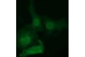 Immunofluorescence (IF) image for anti-EPM2A (Laforin) Interacting Protein 1 (EPM2AIP1) antibody (ABIN1498043) (EPM2AIP1 anticorps)