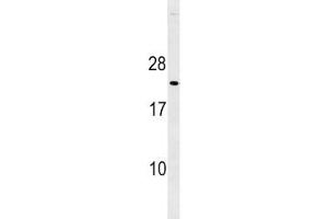 p27Kip1 antibody western blot analysis in mouse heart tissue lysate
