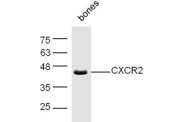 CXCR2 anticorps  (AA 316-360)