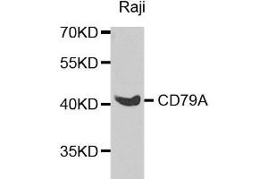 Western blot analysis of extracts of various cell lines, using CD79A antibody. (CD79a anticorps  (AA 33-145))