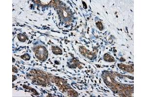Immunohistochemical staining of paraffin-embedded breast tissue using anti-PRKAR2A mouse monoclonal antibody. (PRKAR2A anticorps)