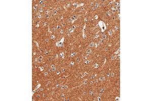Immunohistochemical analysis of paraffin-embedded Human brain tissue using (ABIN6242238 and ABIN6577695) performed on the Leica® BOND RXm.